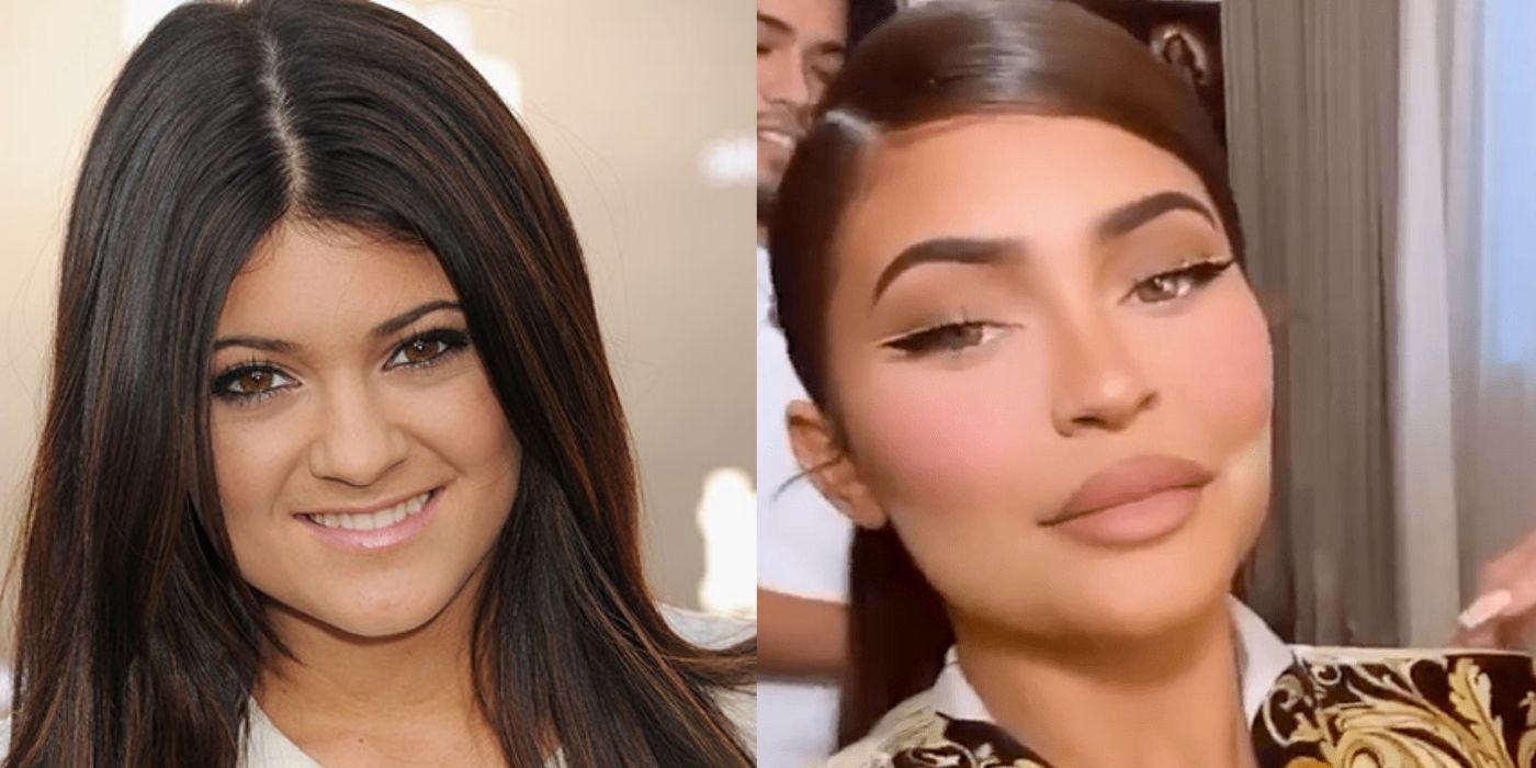 The Kardashians: Kylie Jenner Plastic Surgery Timeline - Vcmp.edu.vn