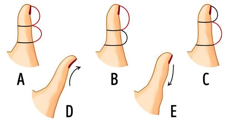 The shape of your thumb according to this vision test will reveal how old your mind is