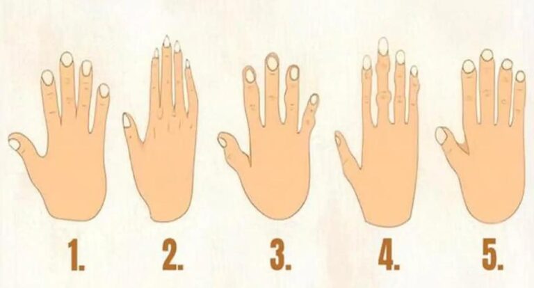 Visual check: choose a hand that is similar to you and understand why you are judged like that