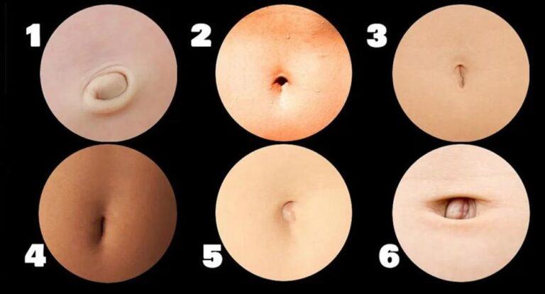 Know your personality by the shape of your belly button