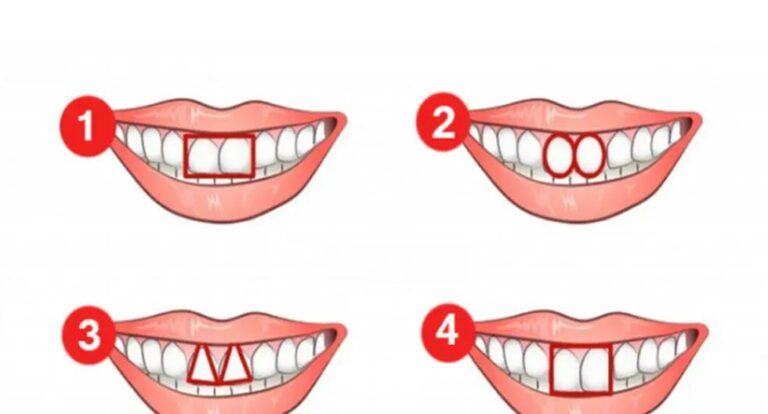 Know your true personality, according to the shape of your teeth