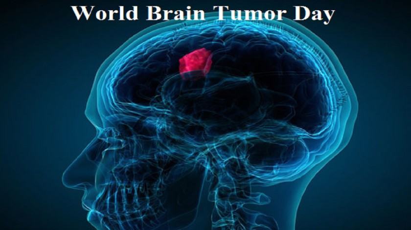 World Brain Tumor Day 2023: Know the theme, history, meaning and facts ...