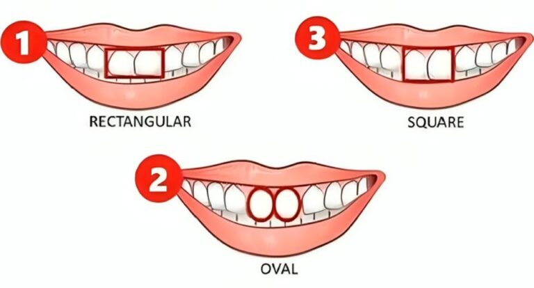 Conoce qué dice la forma de tus dientes sobre ti de acuerdo a este test visual