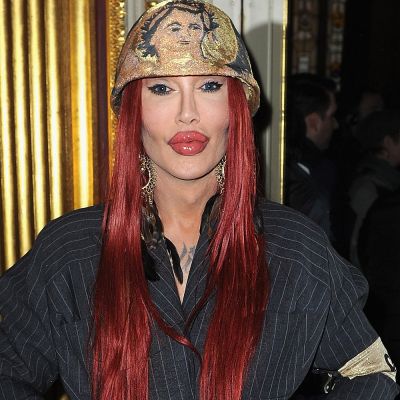 Pete Burns Sexuality: Was She Transgender? Transformation And Surgery Details