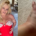 britney-spears-posts-photos-of-swollen-ankle-following-alleged-hotel-fight