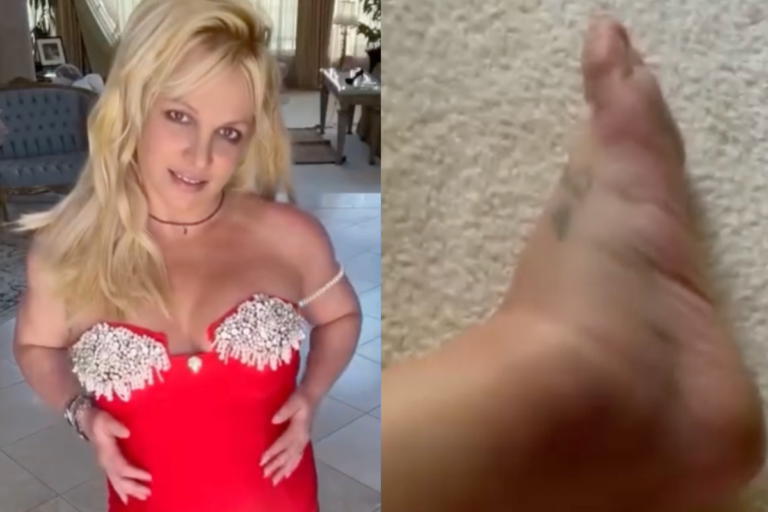 britney-spears-posts-photos-of-swollen-ankle-following-alleged-hotel-fight