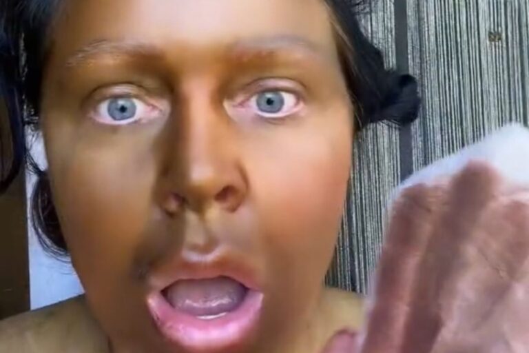 Woman Shocks Internet After Her Skin Turned Green With Fake Tanning Lotions